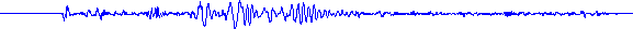 EKG und EEG von 123gif.de