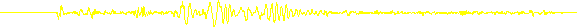 EKG und EEG von 123gif.de